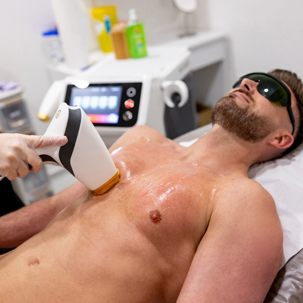 Laser Hair Removal for Men: Prep, Side Effects and More