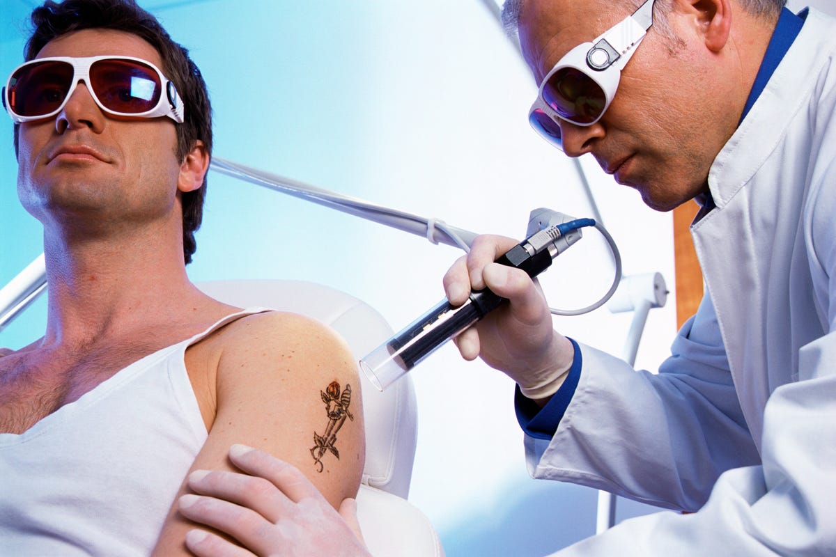 Tattoo Removals: Facts, Cost, Risks, and More