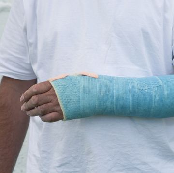 man with a broken wrist