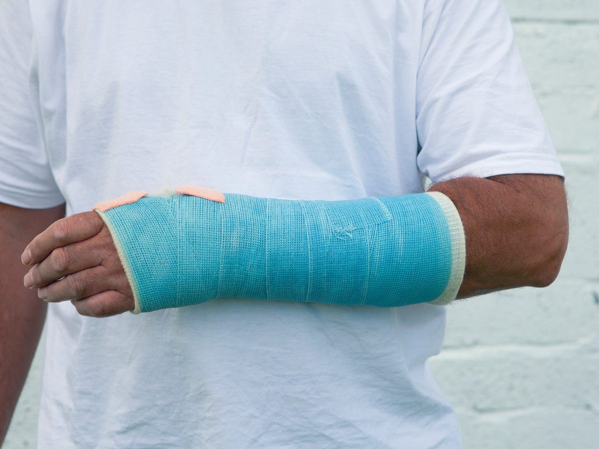 Mag je hardlopen of sporten met een gebroken arm? Mag Je Hardlopen Of Sporten Met Een Gebroken Arm?