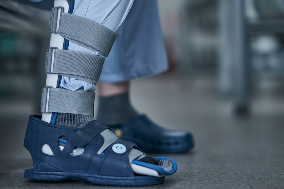 a man with a cast on his leg
