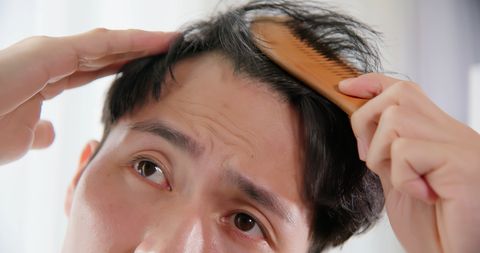 man worried about hair loss
