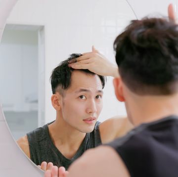 man worry about hair loss