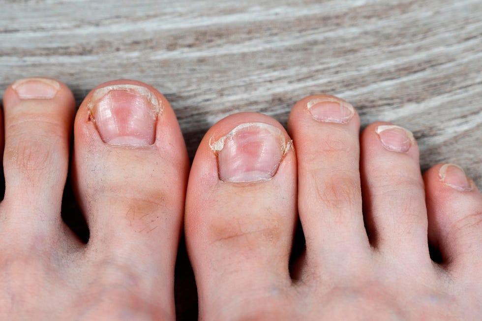 a pair of feet with painted toenails