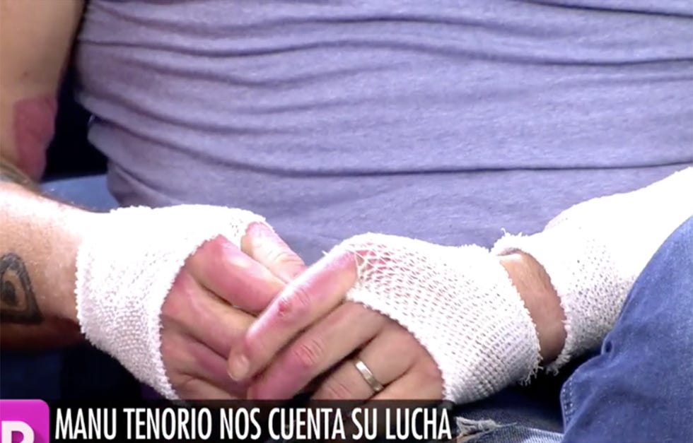 Manu Tenorio ha visitado 'El programa de AR' para hablar de la recuperación del grave accidente doméstico que sufrió el pasado 20 de agosto. El cantante también ha dado detalles sobre cómo vivió ese duro momento.