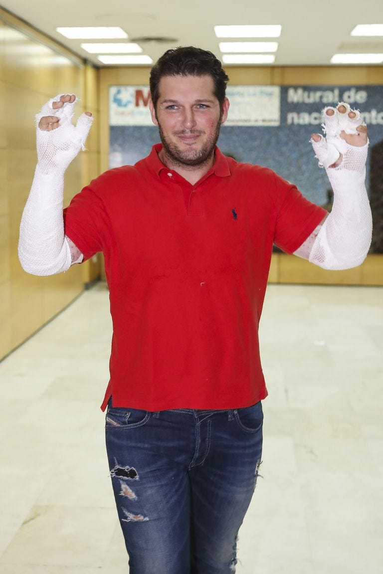 MANU TENORIO RECIBE EL ALTA HOSPITALARIA TRAS SUFRIR QUEMADURAS DE SEGUNDO GRADO