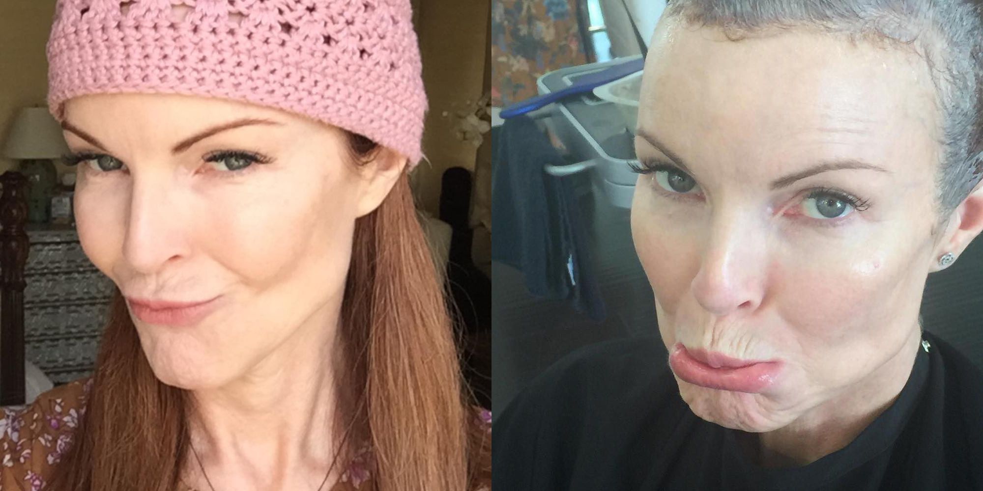 Marcia Cross Reveals She Had Anal Cancer On Instagram picture