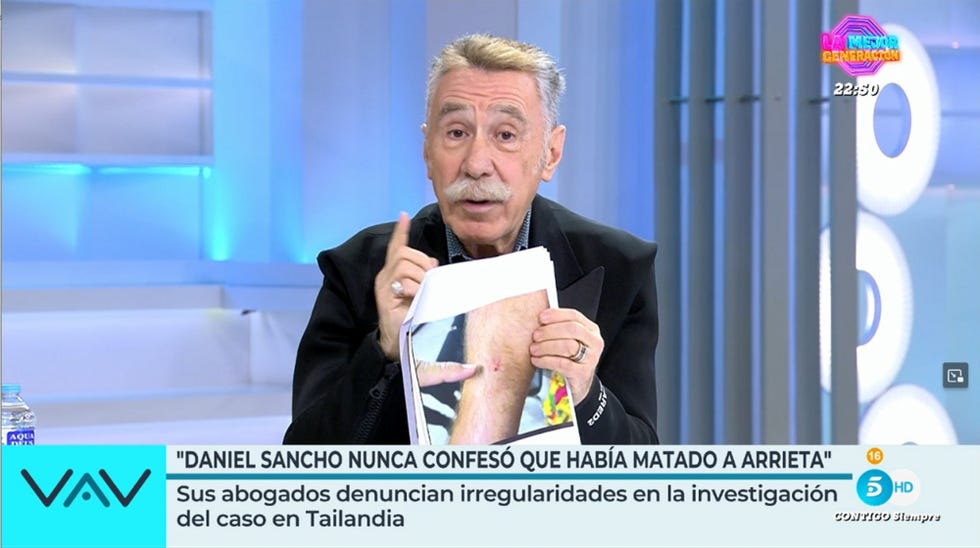 marcos garcia montes en el plato de vamos a ver muestra fotos de las mordeduras en el cuerpo de daniel sancho
