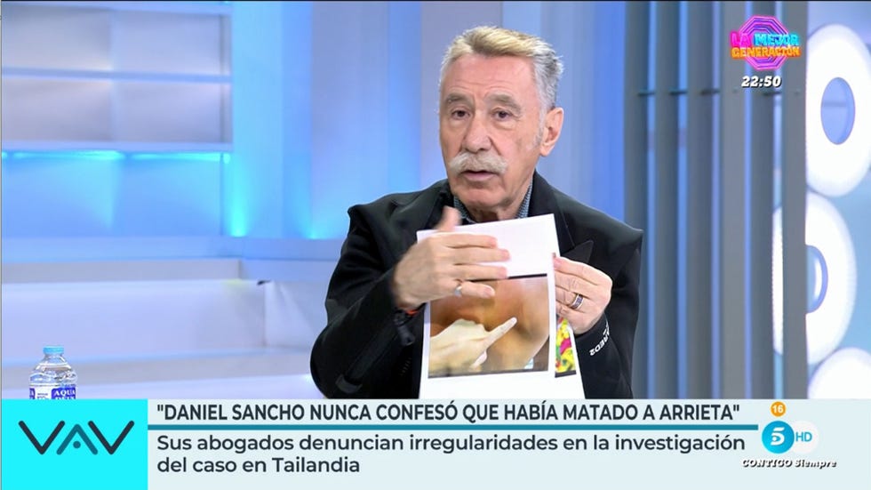 marcos garcia montes en el plato de vamos a ver muestra fotos de las mordeduras en el cuerpo de daniel sancho