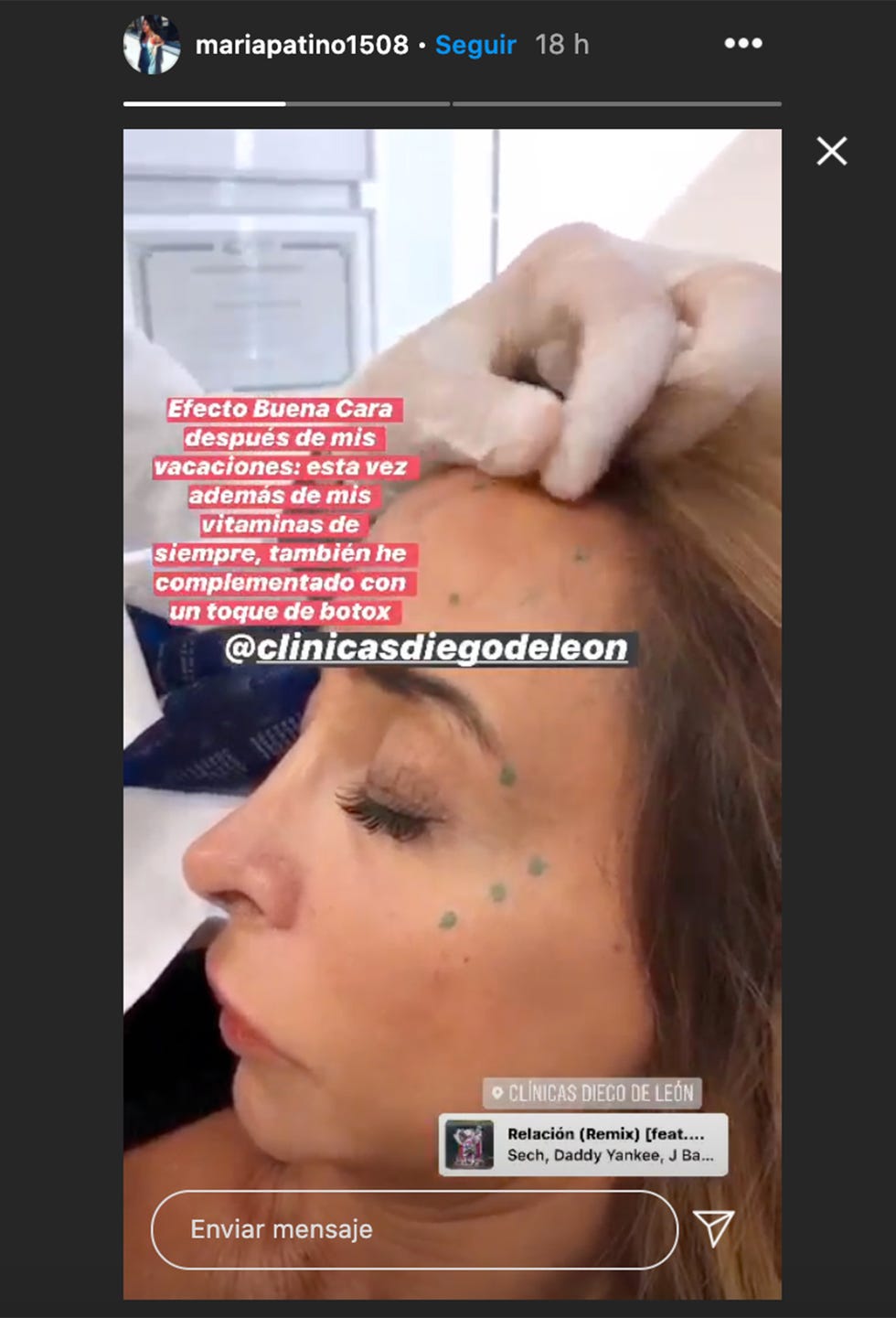 María Patiño maría patiño en su clínica de estética de confianza poniéndose un poco de botox