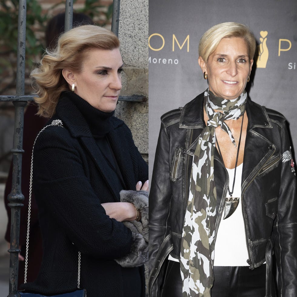 maria zurita antes y despues de su retoque estetico en la nariz