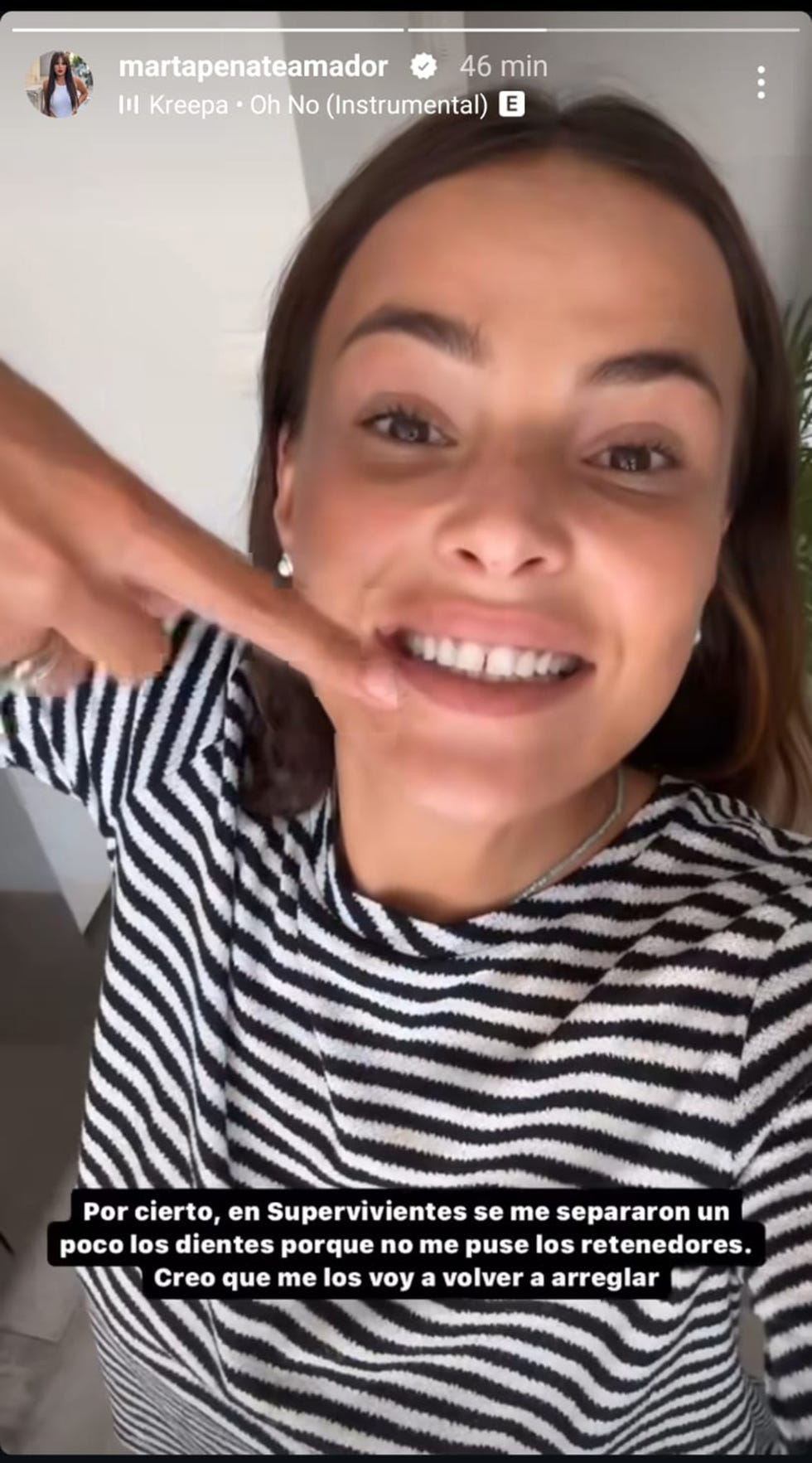 marta penate muestra las secuelas en sus dientes tras supervivientes