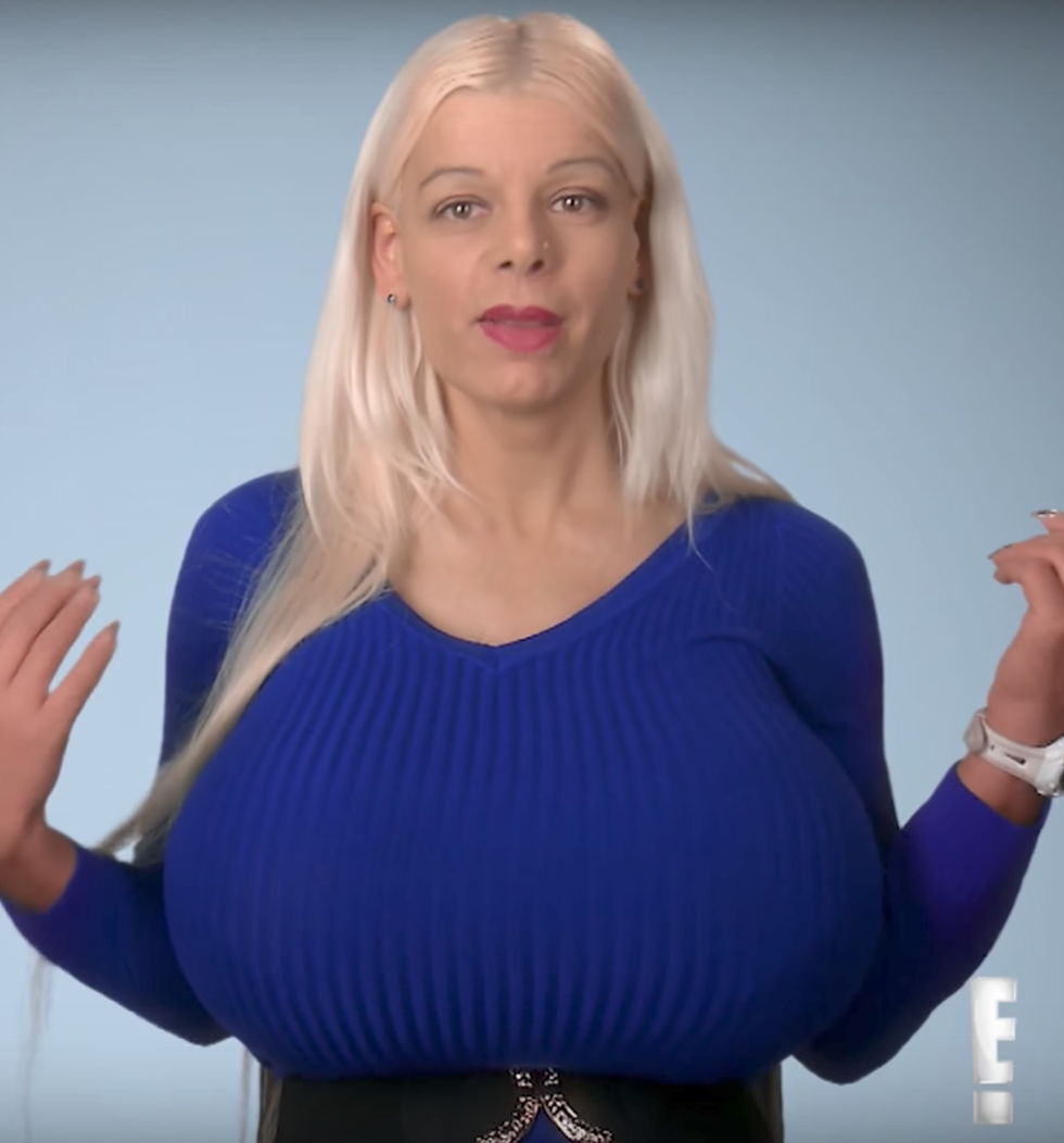 I have the world's largest breast implants - my 38KKK-cup boobs