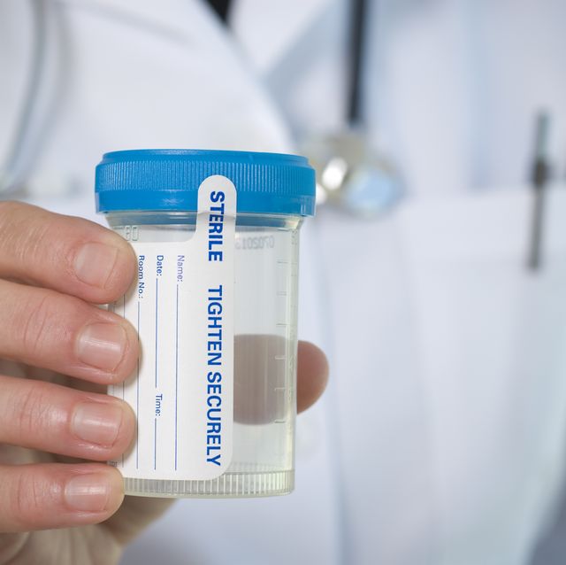 medical personnel hand holding a urine sample bottle