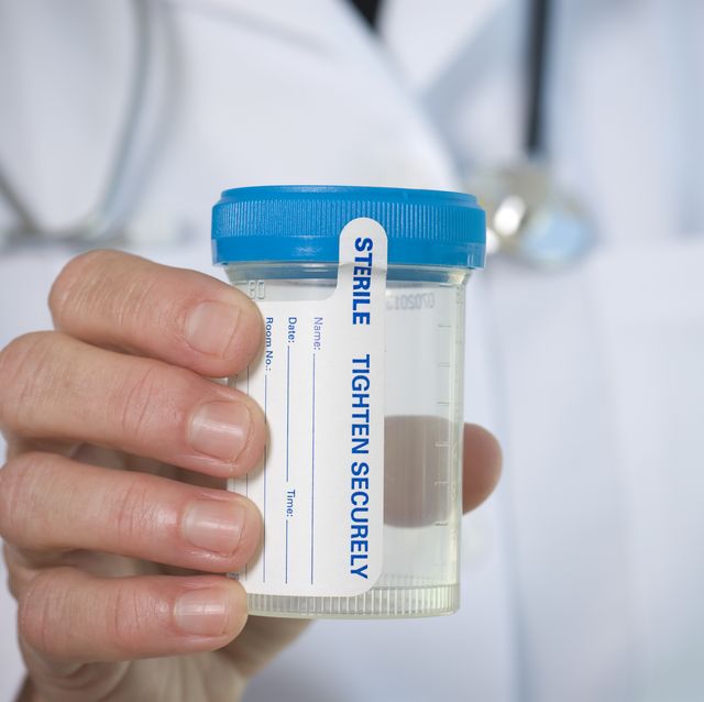 medical personnel hand holding a urine sample bottle
