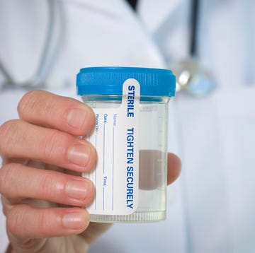 Medical personnel hand holding a Urine sample bottle medical personnel hand holding a urine sample bottle