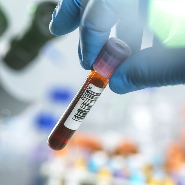 New Study Finds That A Blood Test For Diabetes Might Actually Predict Alzheimer’s Progression 