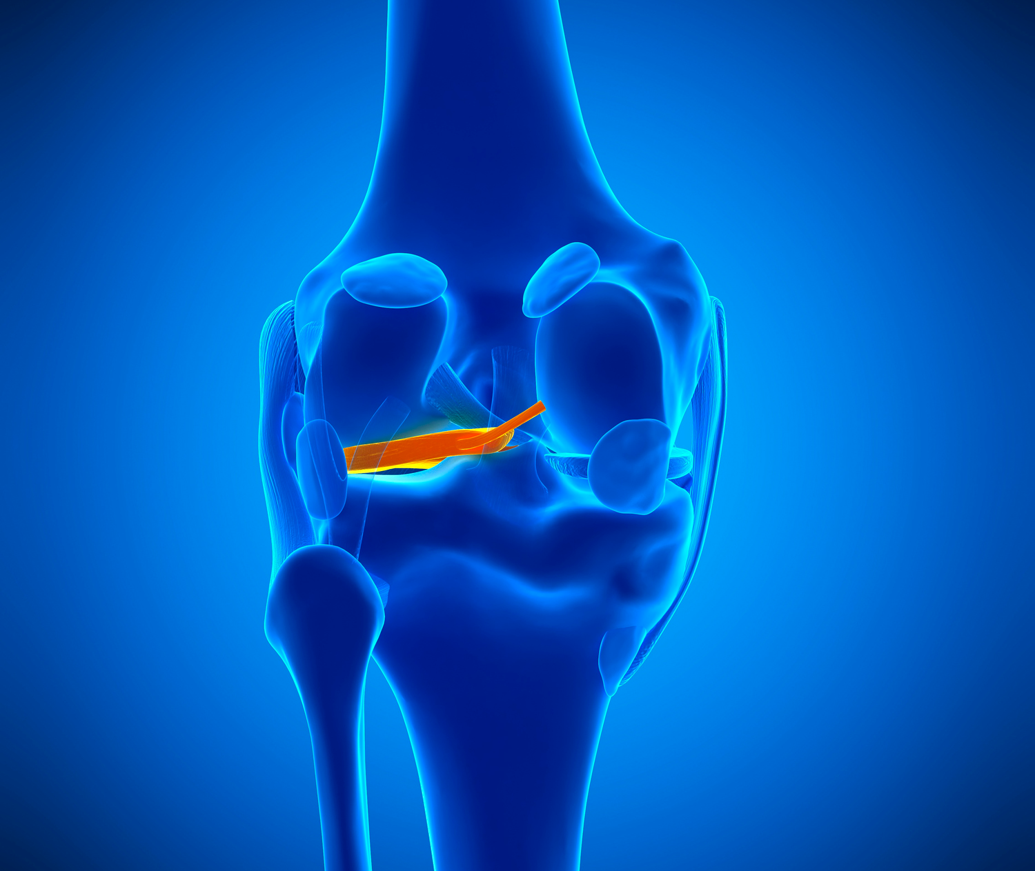 Meniscus Tears: A Treatment Guide For Runners