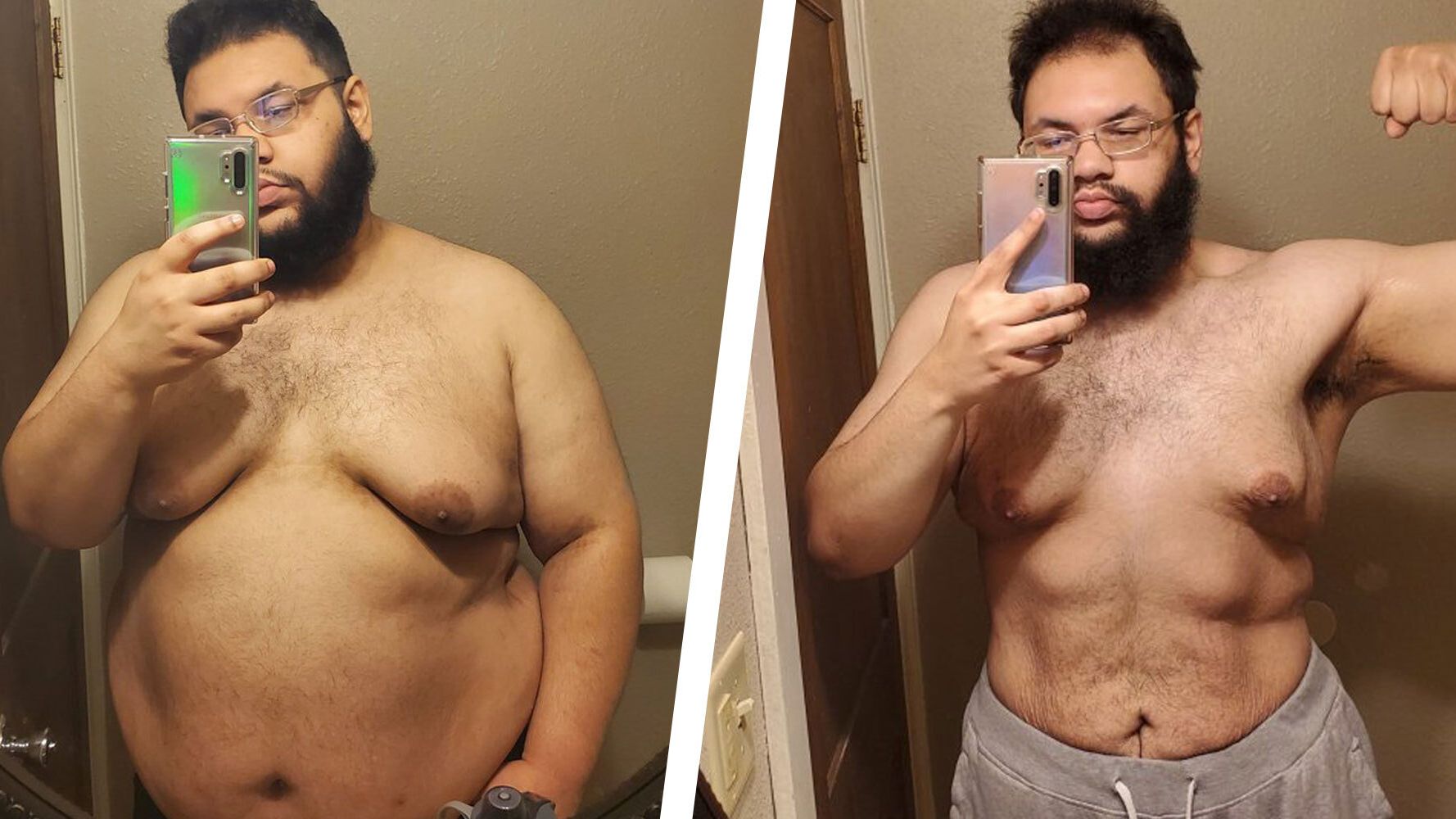 I Lost 300lbs In Just 18 Months