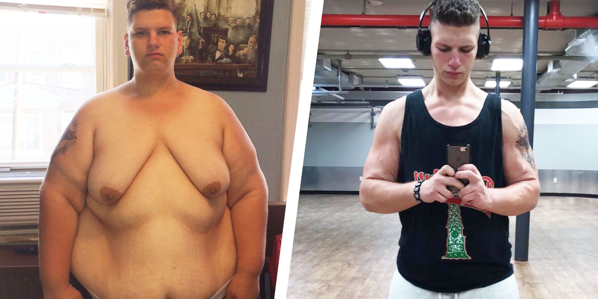 Gastric Bypass Before And After Pictures Men