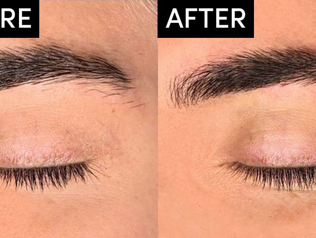 What Is Microblading The Costs Risks