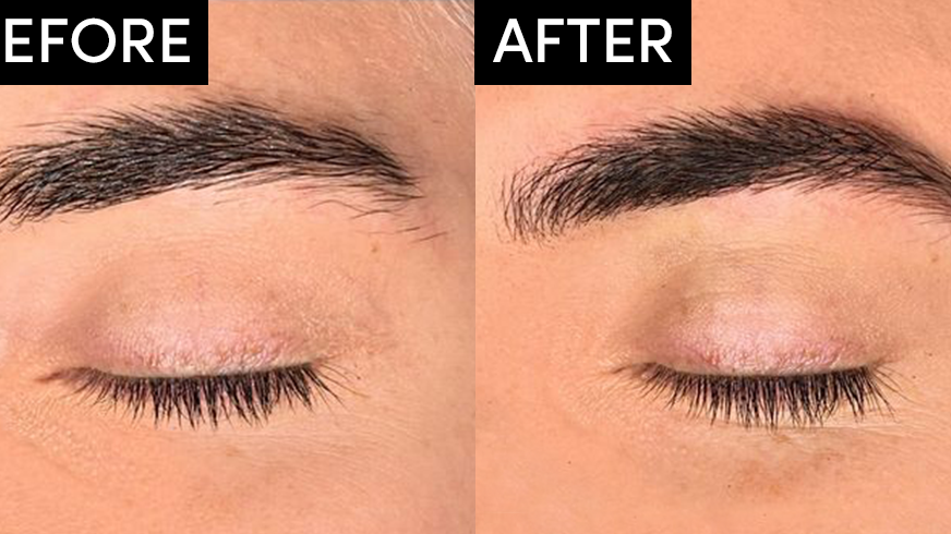 What Is Microblading? The Costs, Risks, Pain, and Downsides 2023