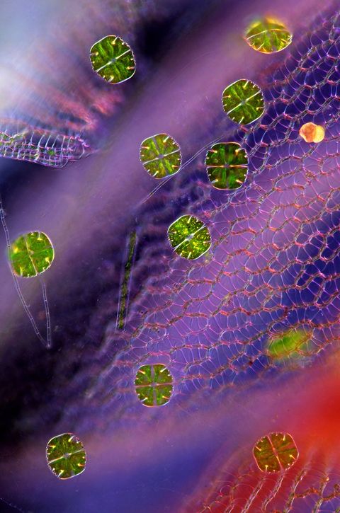 Cellen van Micrasterias truncata een eencellige sieralg zweven in de buurt van een paar blaadjes veenmos Deze zoetwateralg werd voor het eerst in 1848 wetenschappelijk beschreven en ontleent zijn naam aan zijn tweezijdige voorkomen