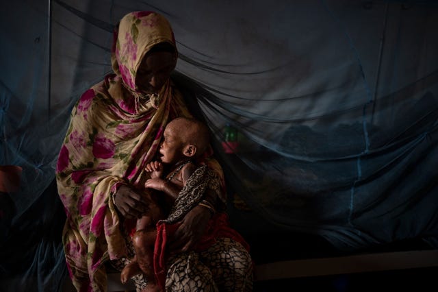 In een medisch centrum dat door de hulporganisatie Save the Children in Baidoa wordt gefinancierd houdt Khadijo Ibrahim Abikar 50 haar zwaar ondervoede 2jarige kleindochter Naima Adan Ali in de armen De foto werd genomen op de tiende dag van Naimas behandeling en haar gezondheid ging vooruit We zijn hier vanwege de droogte gekomen zegt Abikar We hebben al ons vee verloren en onze akkers zijn aangetast door de sprinkhanen Vroeger hadden we meer dan 55 geiten en 45 runderen Nu hadden we alleen nog maar kamelen en die geven geen melk omdat ze te weinig voer krijgen
