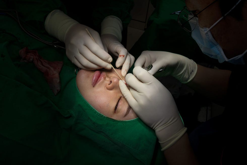 Hyejin Yun ondergaat een ooglidoperatie in de kliniek Hyundai Aesthetics in Seoul een ingreep die haar ogen groter doet lijken In ZuidKorea wordt meer aan plastische chirurgie gedaan dan in enig ander land ter wereld een op de drie vrouwen tussen 19 en 29 jaar heeft er een cosmetische ingreep laten doen