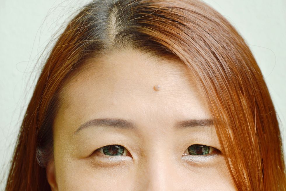 mole in woman forehead shows physiognomy