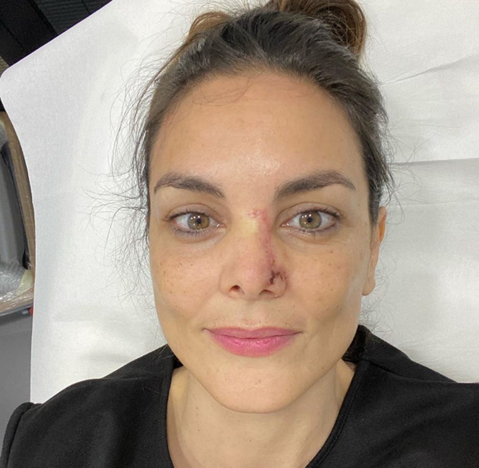mónica carrillo confiesa su lucha contra el cáncer