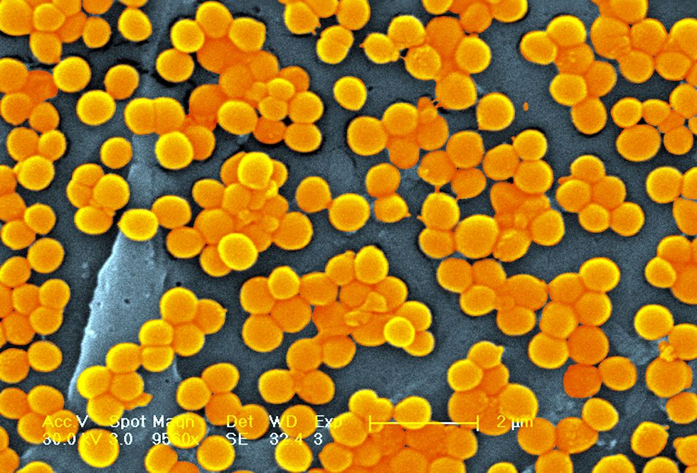 methicillin-resistant mrsa staph bacteria