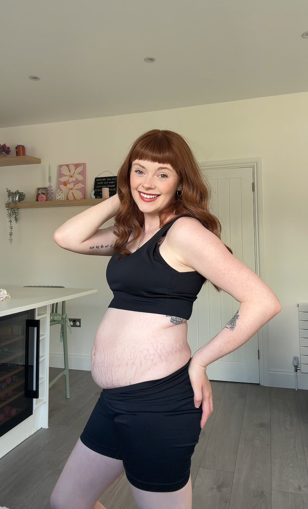 My postpartum belly went viral because of my stretch marks”