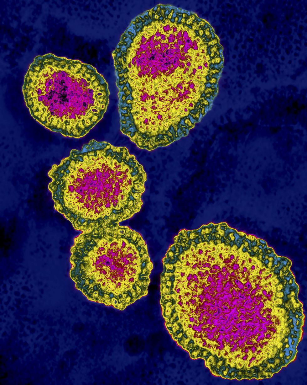 influenza a h1n1 virus