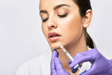 natural looking lip fillers