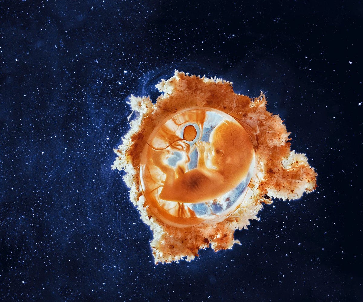 Virussen zijn gevreesde ziekteverwekkers maar hebben vanaf het eerste begin een belangrijk stempel gedrukt op de evolutie Zon acht procent van ons DNA is afkomstig van virussen die onze vroegste voorouders hebben besmet en erfelijk materiaal in hun genoom hebben achtergelaten Sommige van die virale genen spelen een belangrijke rol bij de groei van het embryo en de placenta rondom deze dertien weken oude foetus