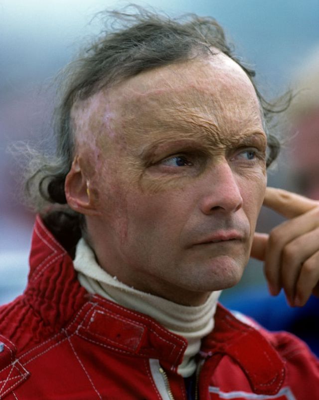 Niki Lauda, Grand Prix Of Detroit
