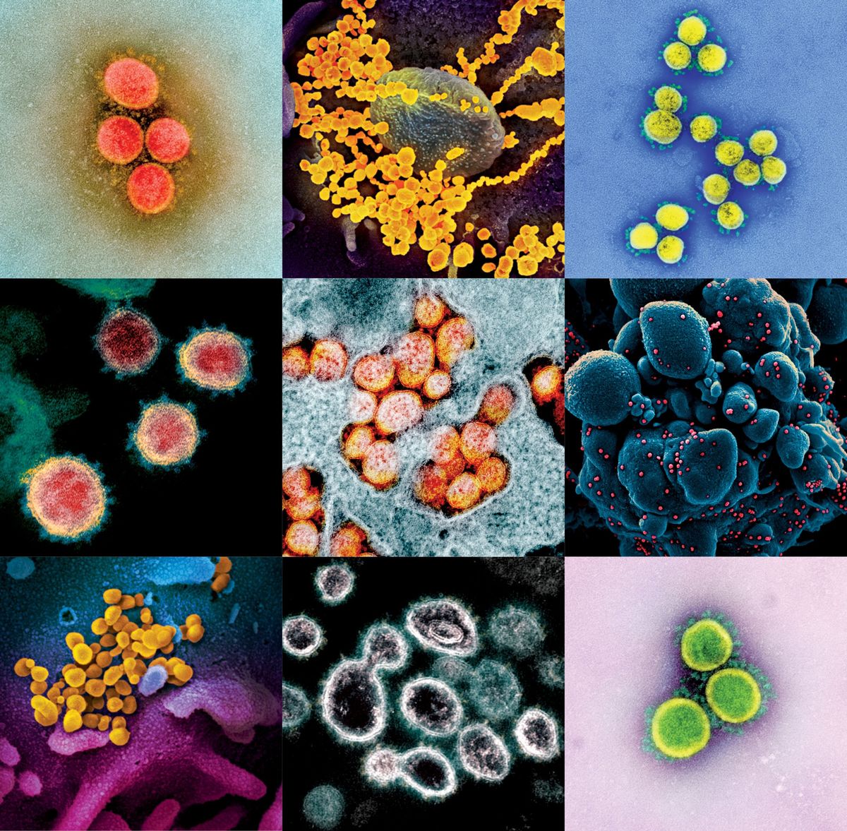 Microscopische beelden met versterkte kleuren van deeltjes van het nieuwe coronavirus SARSCOV2