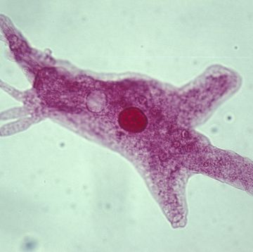 ameba amoeba proteus shows nucleus,contractile vaculoe, pseudopods 100x