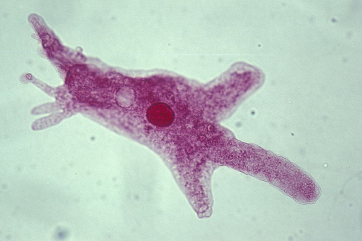 ameba amoeba proteus shows nucleus,contractile vaculoe, pseudopods 100x