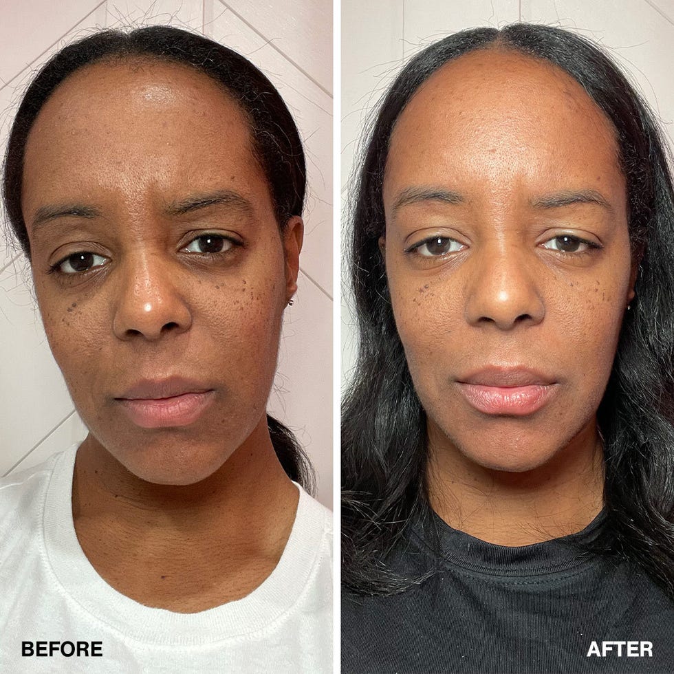 medik8 crystal retinal eye before/after