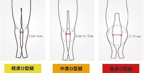 Joint, Leg, Shoulder, Human body, Human anatomy, Muscle, Bone, Knee, 
