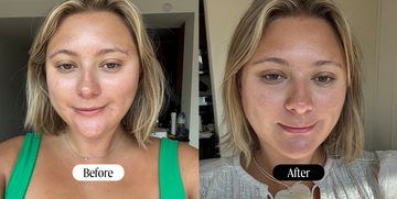 olay super serum before and after