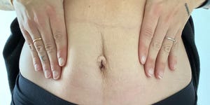 ‘My Journey to Loving My Post-Pregnancy Tummy’	