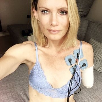 Stuntwoman Olivia Jackson, after suffering injury on Resident Evil: The Final Chapter.