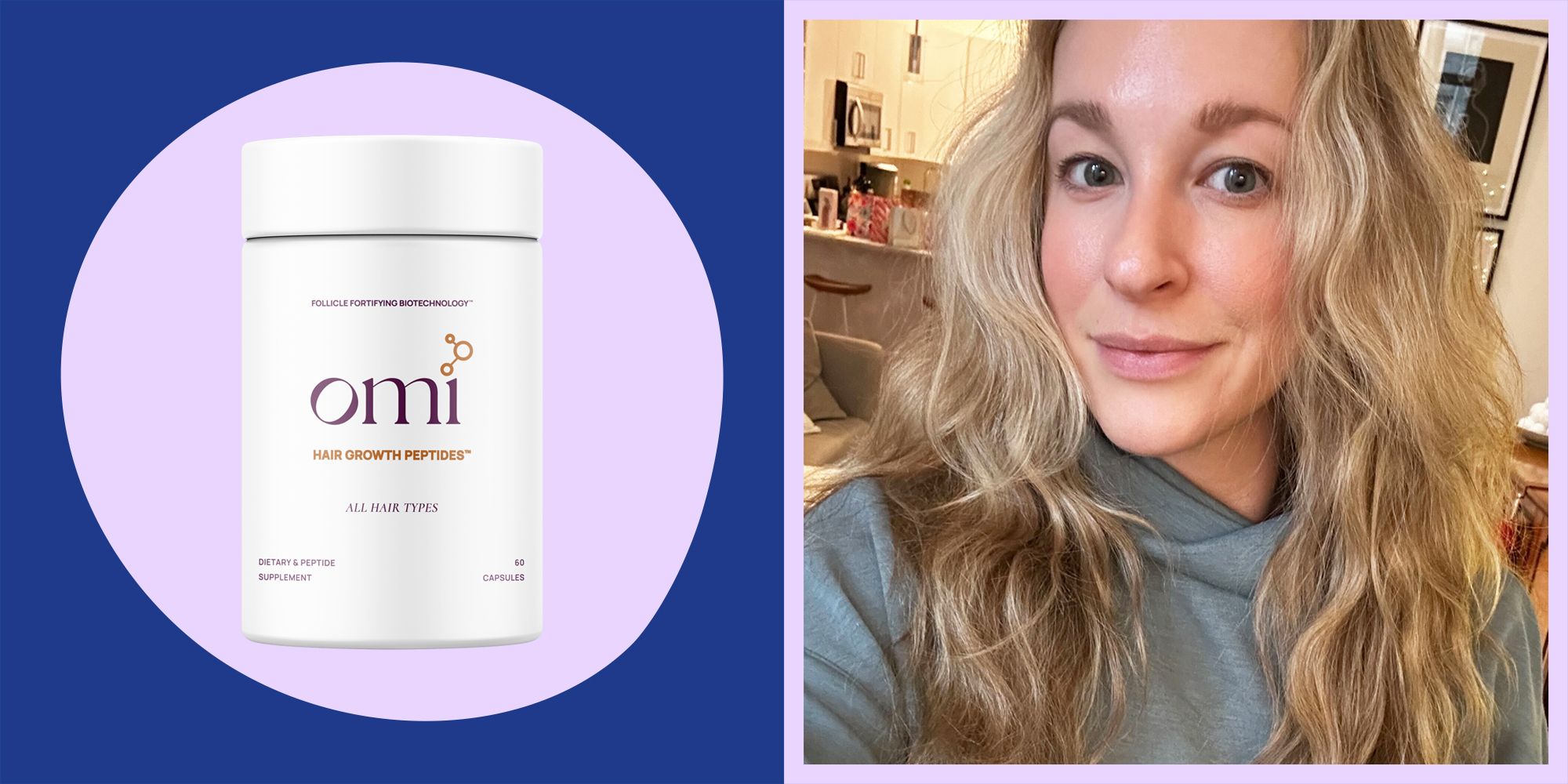 Omi Well Beauty Hair Growth Peptides Review Pros Cons Are They Worth It
