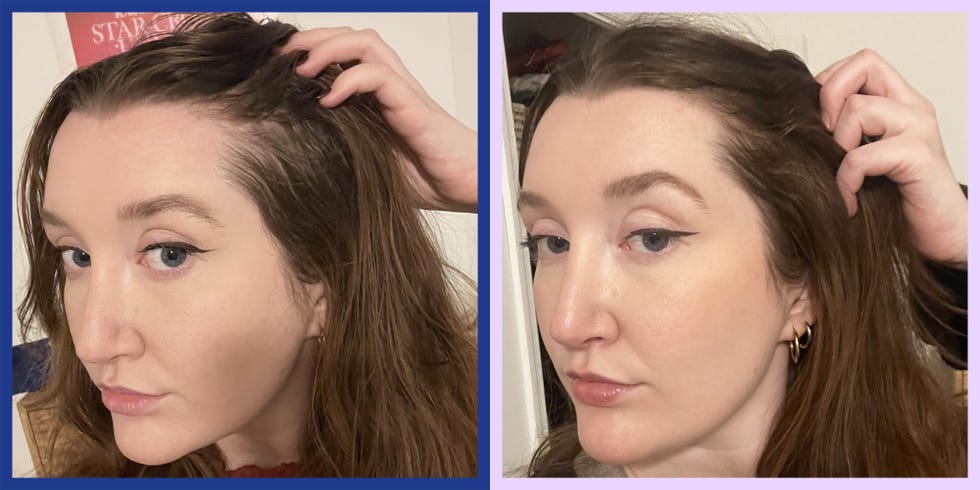 charlotte walsh omi wellbeauty hair growth peptides before and after photos