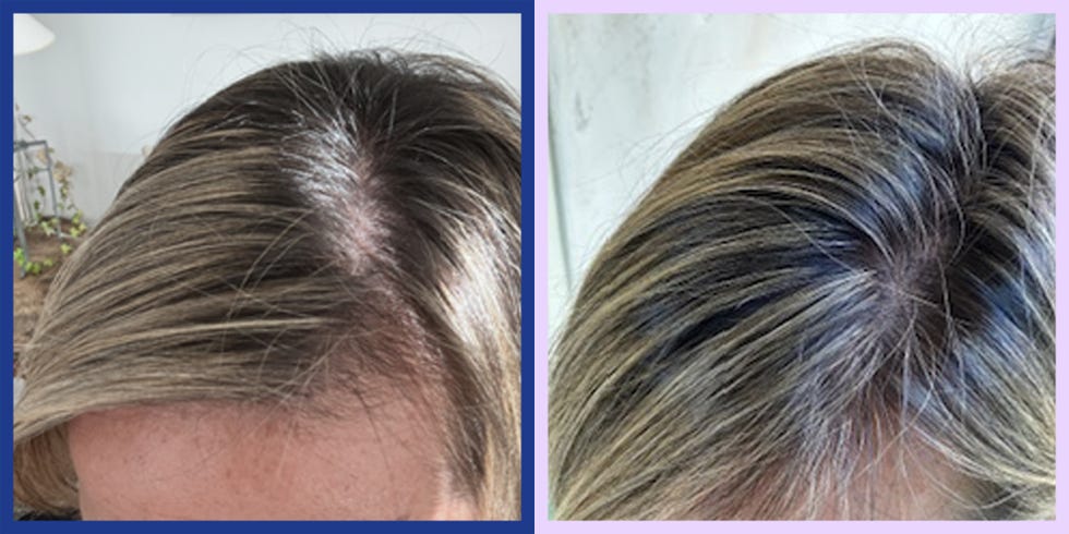 kristen saladino omi wellbeauty hair growth peptides before and after photos