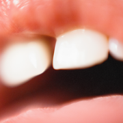 close up photo of someone's mouth with parted lips revealing teeth and tongue
