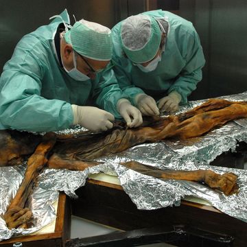 Onderzoekers nemen monsters van de maaginhoud van tzi de Ijsman om precies te kunnen bepalen uit welke plantaardige en dierlijke ingredinten zijn laatste maaltijd bestond